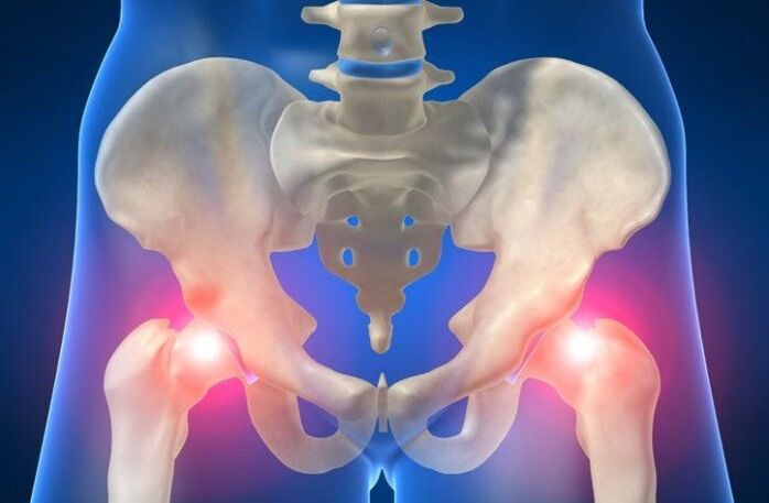 douleur dans l'articulation de la hanche