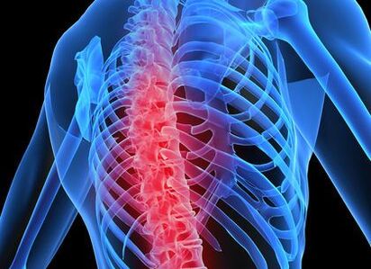 ostéochondrose de la colonne thoracique