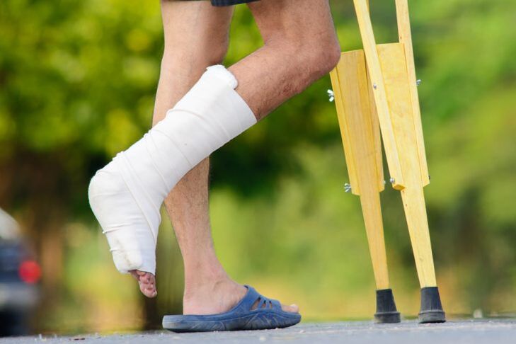 blessure à la cheville comme cause de l'arthrose